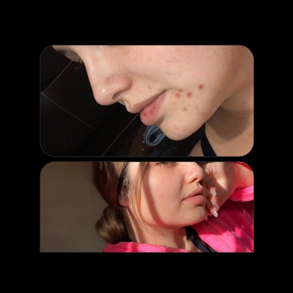 Skin care - Picture 2 of 4